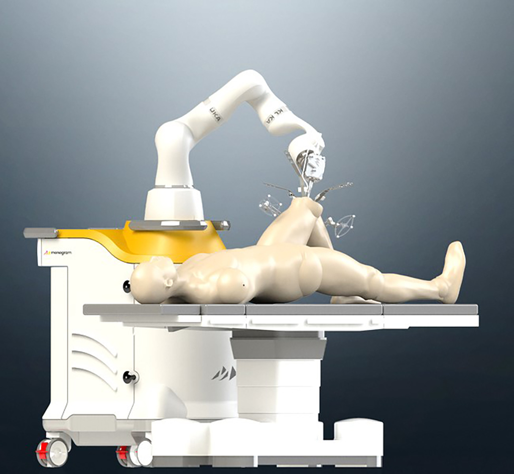 KUKA機器人適用各種醫療技術應用；圖為KUKA LBR Med醫療型協作機器人與Monogram共同打造機器人輔助系統，客製化膝關節置換程序。圖／庫卡提供