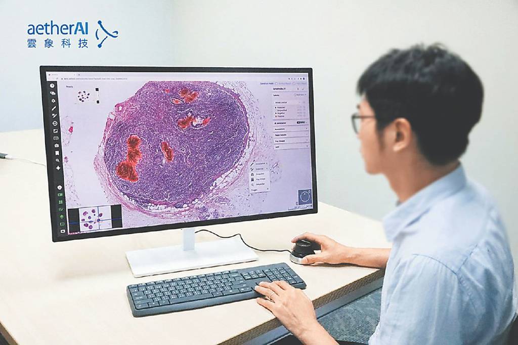 雲象科技深耕醫療影像AI 業績嗨
