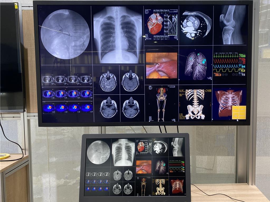 鈺緯首度亮相Mini LED醫療顯示器