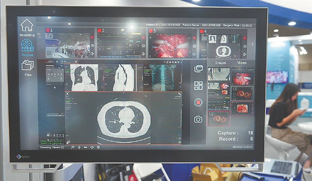 友達、佳世達 醫療科技展秀肌肉