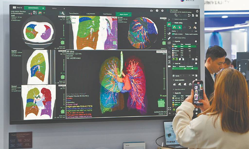 醫療科技展吸金 醫材股奮起