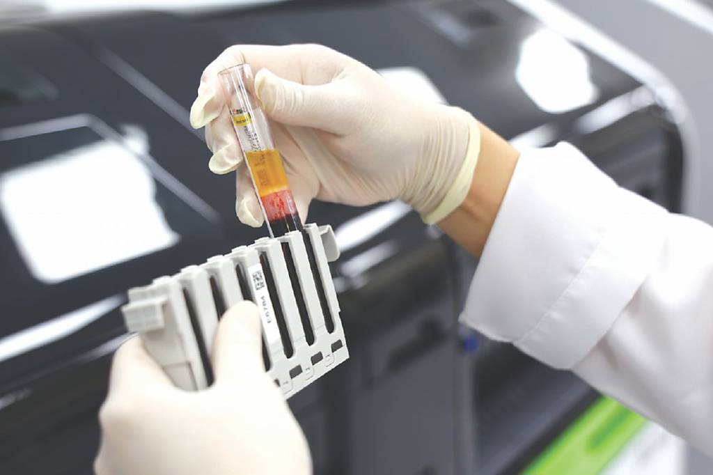 數據正常為何仍猝死?